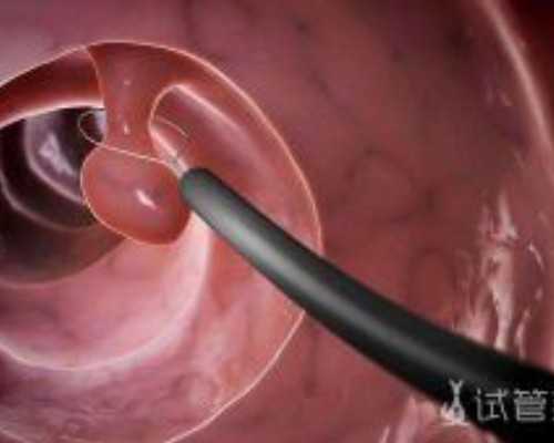 国内供卵公司排行,中日联谊医院做三代借卵试管性别选择要多少钱？