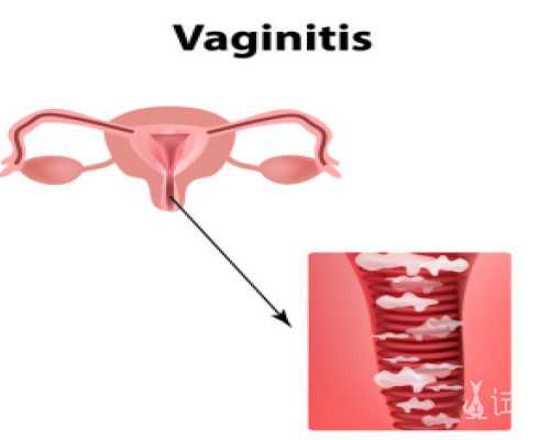 国内供卵自怀套餐,绝经移植囊胚需不需要打肝素有答案了，详解其三大好处