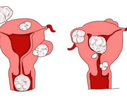 国内代孕中介,此为吉兆!孕妇梦见桑葚的相关胎梦含义解读