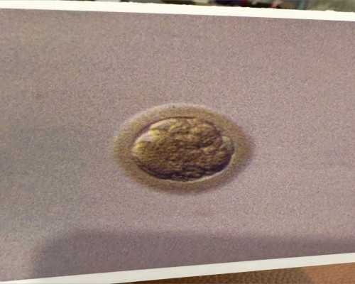 国内供卵机构有哪几家公司,怎么能让男人y染色体精子质量提高戳，吃碱性食物只是其一